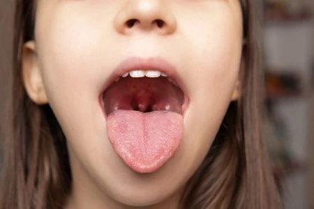 Have You Examined Your Tongue Lately?